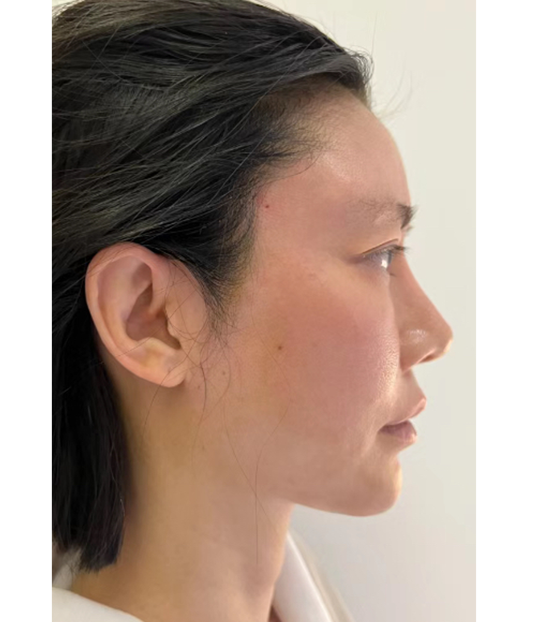 After treatment