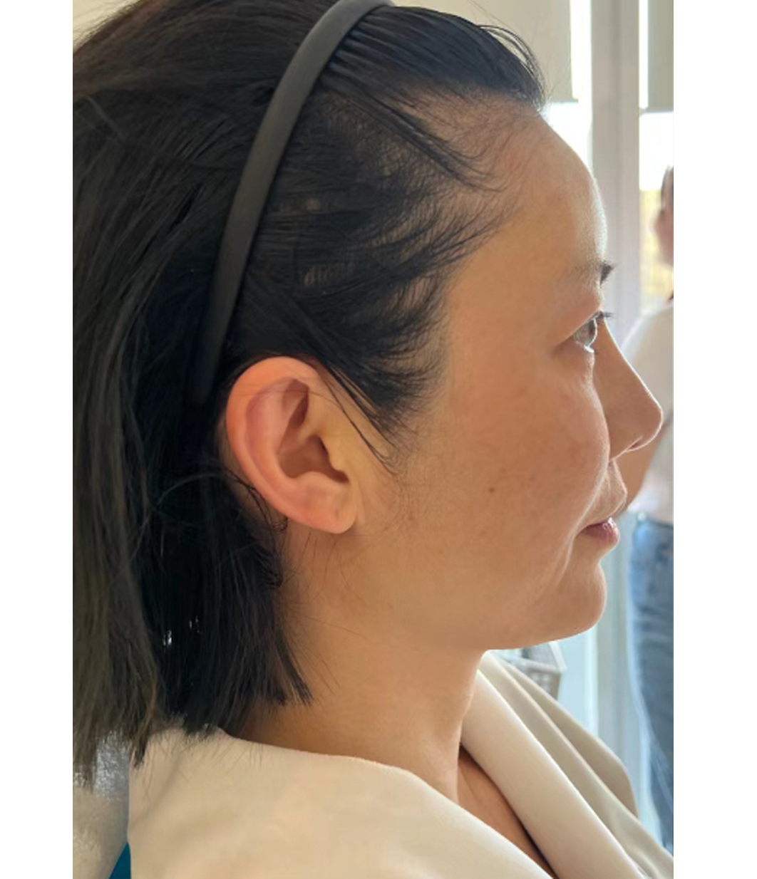 Before treatment